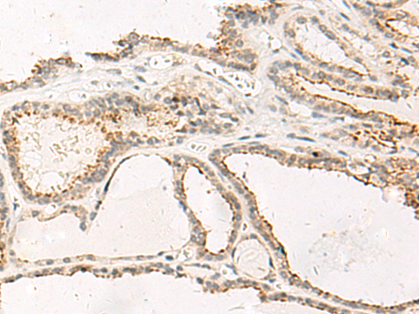 Rabbit Polyclonal Antibody to MCHR2