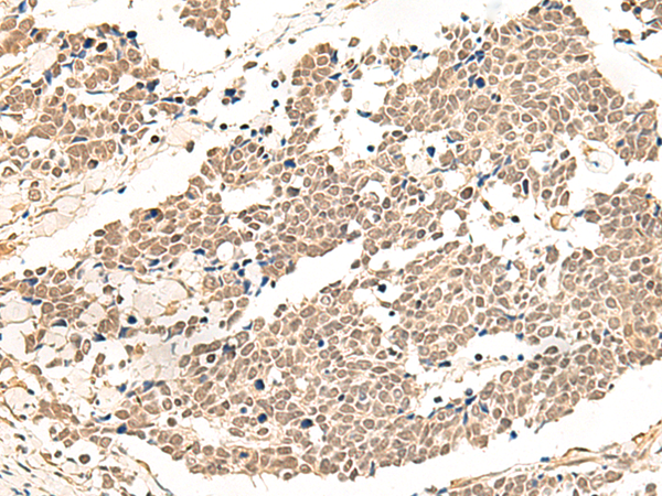 Rabbit Polyclonal Antibody to GPR139
