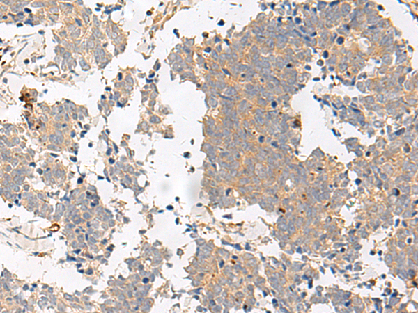 Rabbit Polyclonal Antibody to GPR153