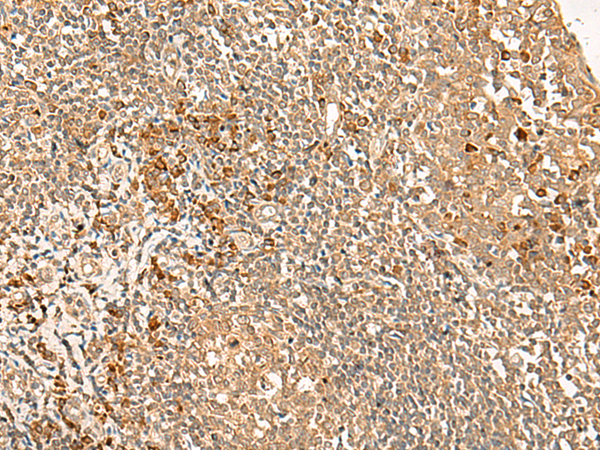 Rabbit Polyclonal Antibody to GPR162