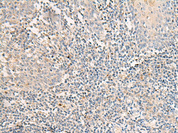 Rabbit Polyclonal Antibody to GPR176