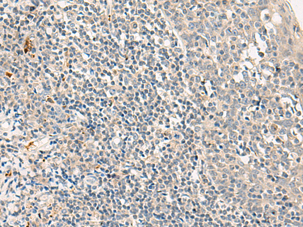 Rabbit Polyclonal Antibody to GPR180