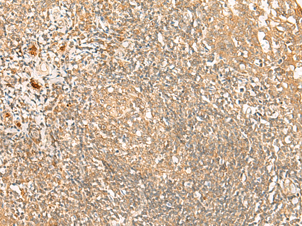 Rabbit Polyclonal Antibody to PROKR1