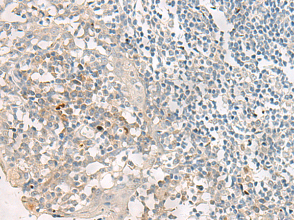 Rabbit Polyclonal Antibody to PROKR2