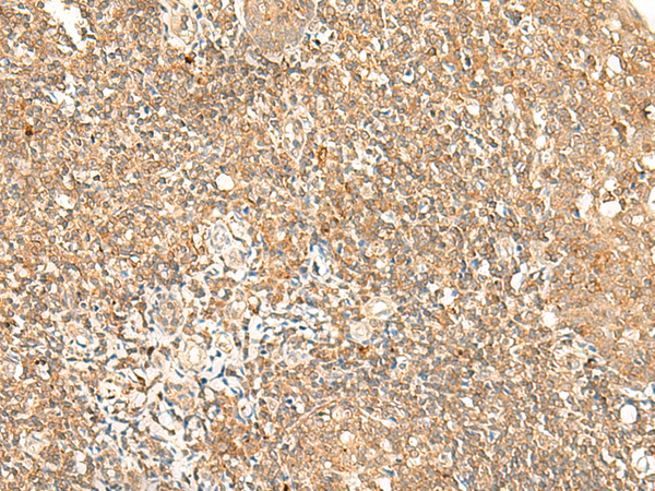Rabbit Polyclonal Antibody to GPR89A/GPR89B