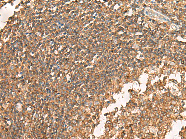 Rabbit Polyclonal Antibody to GPSM2