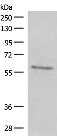 Rabbit Polyclonal Antibody to GPT2