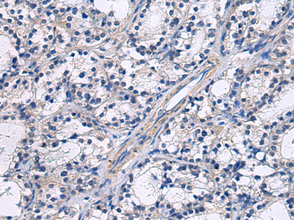 Rabbit Polyclonal Antibody to GRAMD2A