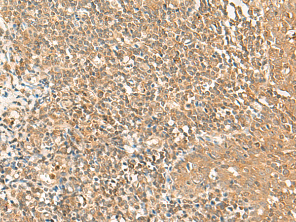 Rabbit Polyclonal Antibody to GRIPAP1