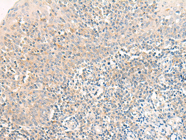 Rabbit Polyclonal Antibody to RAPGEF1
