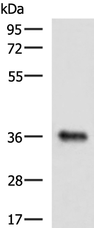 Rabbit Polyclonal Antibody to GRHPR