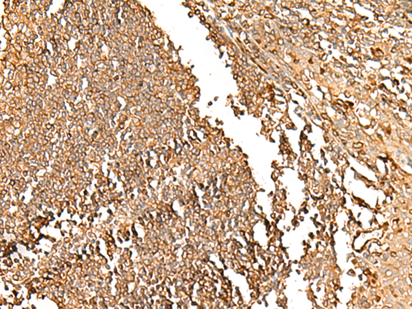 Rabbit Polyclonal Antibody to GRIK2