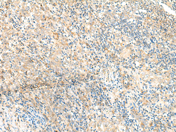 Rabbit Polyclonal Antibody to GRIK1