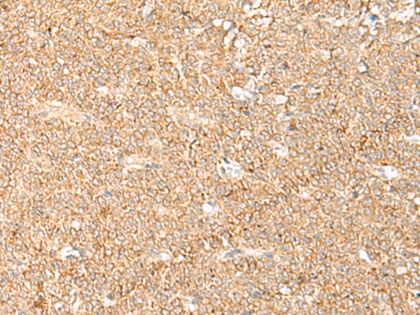 Rabbit Polyclonal Antibody to LGALSL