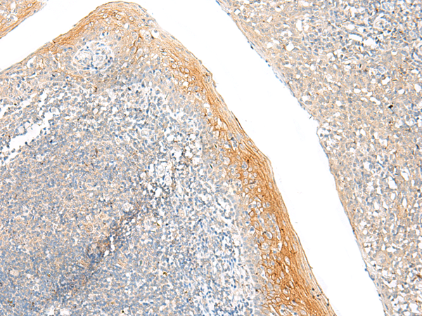 Rabbit Polyclonal Antibody to FAM110D