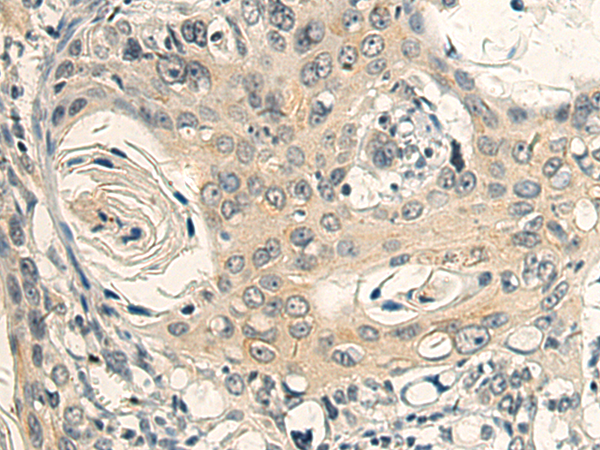 Rabbit Polyclonal Antibody to GRTP1