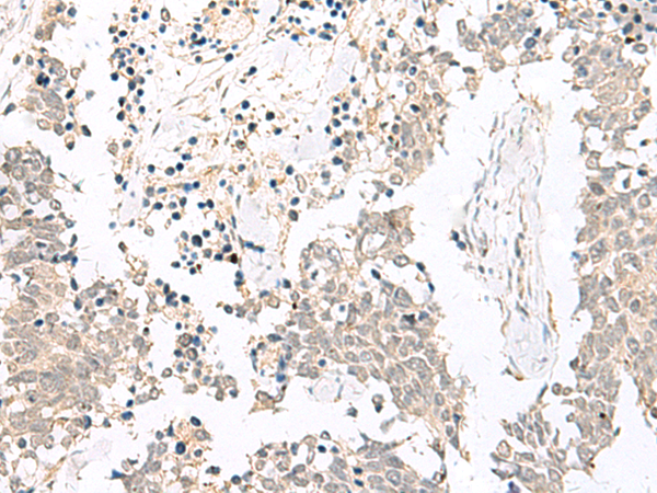 Rabbit Polyclonal Antibody to GSC