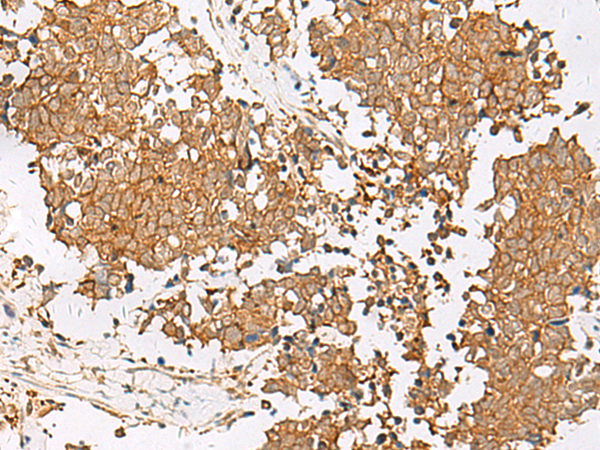 Rabbit Polyclonal Antibody to GSTM2