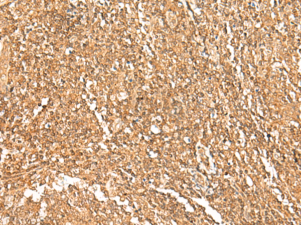 Rabbit Polyclonal Antibody to GTF3A