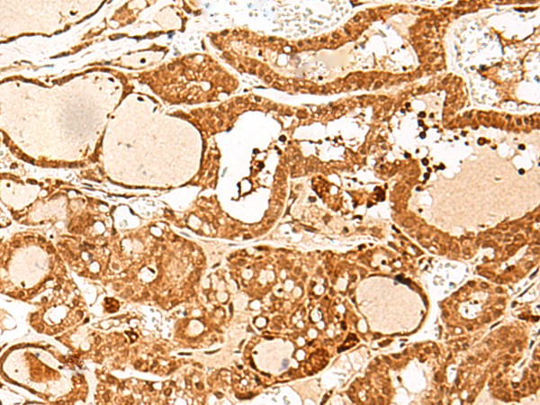 Rabbit Polyclonal Antibody to GTF3C3
