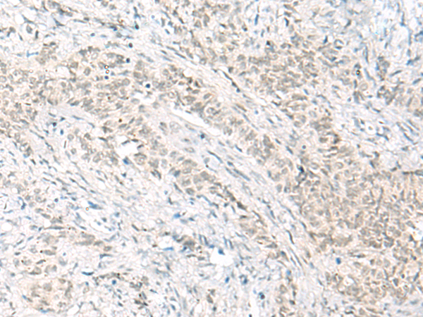 Rabbit Polyclonal Antibody to HABP4