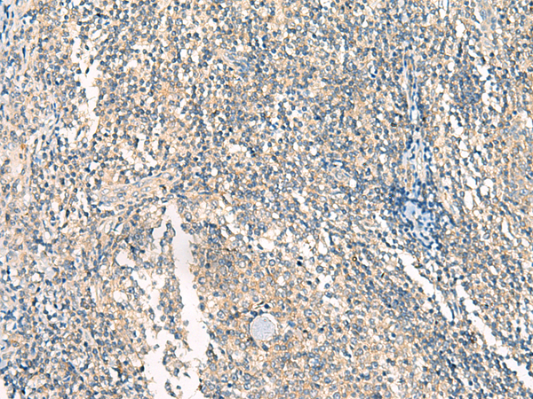 Rabbit Polyclonal Antibody to HASPIN