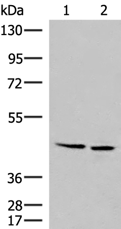 Rabbit Polyclonal Antibody to MNX1
