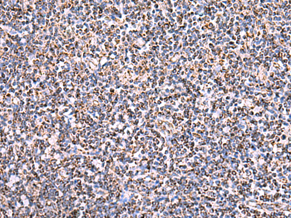 Rabbit Polyclonal Antibody to HSF2BP
