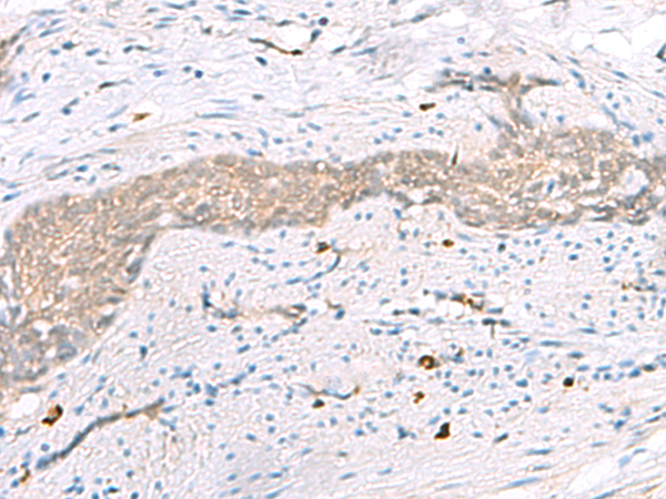 Rabbit Polyclonal Antibody to RBM26