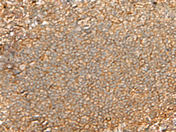 Rabbit Polyclonal Antibody to GNGT2