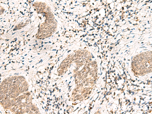 Rabbit Polyclonal Antibody to SNRPG