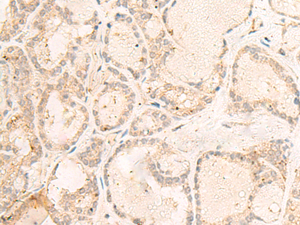 Rabbit Polyclonal Antibody to RGR