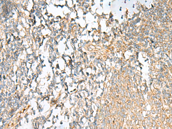 Rabbit Polyclonal Antibody to PAIP2