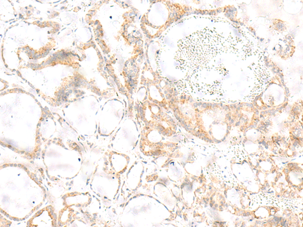Rabbit Polyclonal Antibody to EOGT