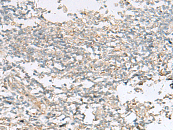 Rabbit Polyclonal Antibody to HECA