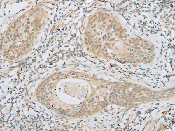 Rabbit Polyclonal Antibody to HELT