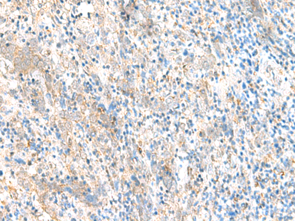 Rabbit Polyclonal Antibody to ERI1