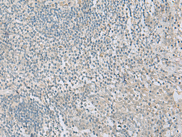 Rabbit Polyclonal Antibody to HHIP
