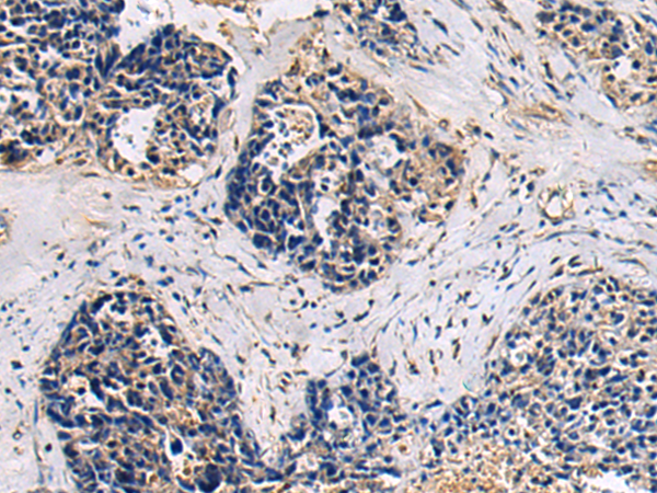 Rabbit Polyclonal Antibody to HIC2