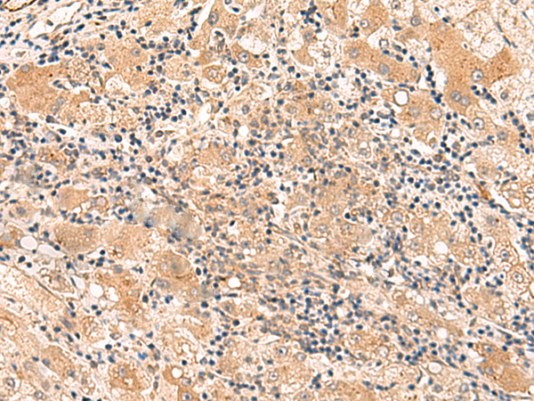 Rabbit Polyclonal Antibody to HPCA
