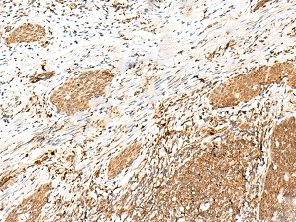 Rabbit Polyclonal Antibody to KAT6A
