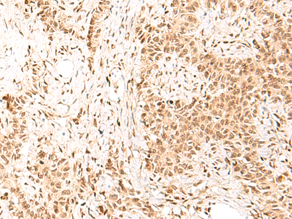 Rabbit Polyclonal Antibody to H1-3