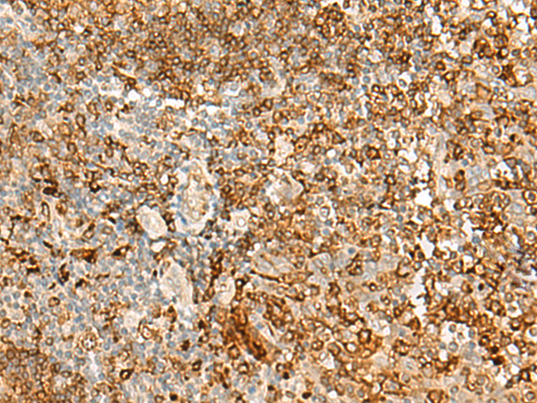 Rabbit Polyclonal Antibody to HLA-DRB1