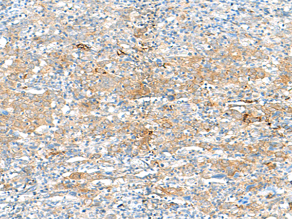 Rabbit Polyclonal Antibody to HLA-DRB3