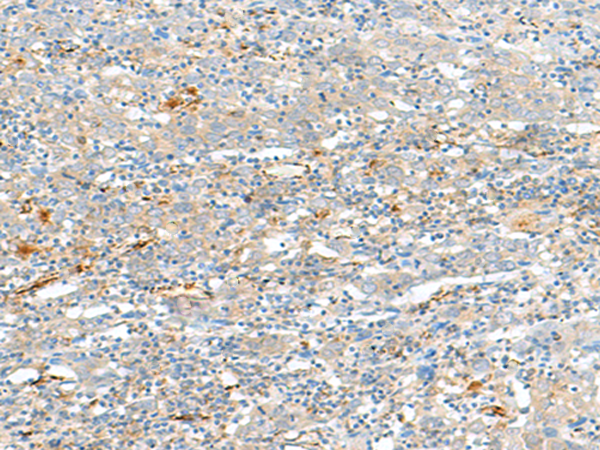Rabbit Polyclonal Antibody to HLA-DQA2
