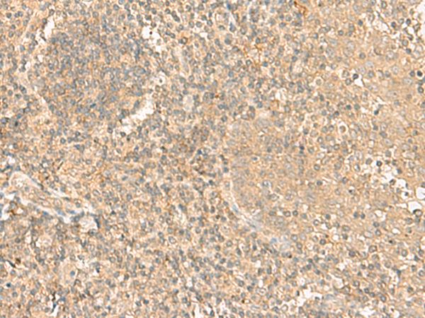 Rabbit Polyclonal Antibody to HLA-A/F/H