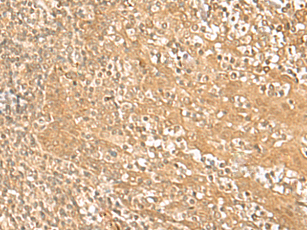 Rabbit Polyclonal Antibody to HMBOX1