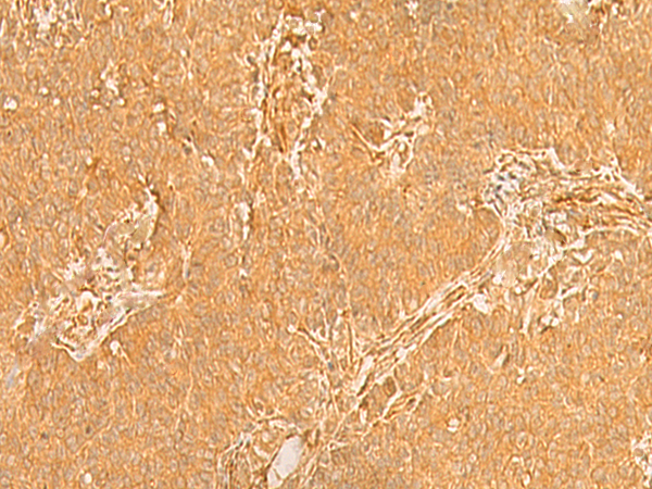 Rabbit Polyclonal Antibody to KRT76
