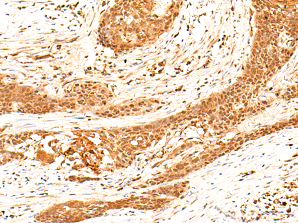Rabbit Polyclonal Antibody to HNF4A