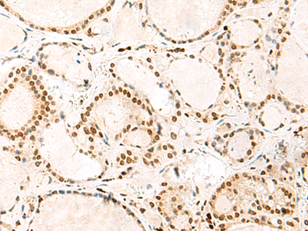 Rabbit Polyclonal Antibody to HNRNPA3